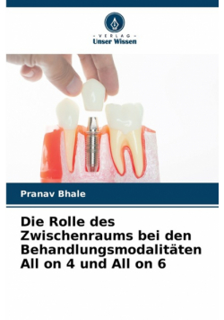 Die Rolle des Zwischenraums bei den Behandlungsmodalitäten All on 4 und All on 6
