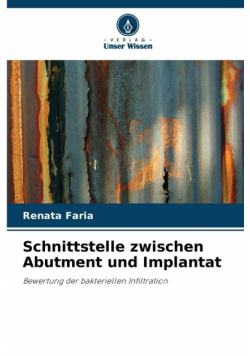 Schnittstelle zwischen Abutment und Implantat