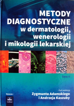 Metody diagnostyczne w dermatologii wenerologii Tom 2