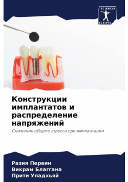 Конструкции имплантатов и распределение напряжений