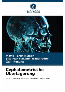 Cephalometrische Überlagerung