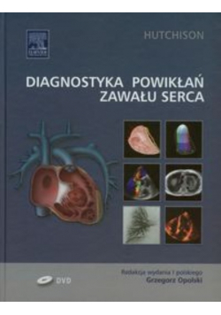 Diagnostyka powikłań zawału serca z DVD