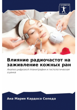 Влияние радиочастот на заживление кожных ран