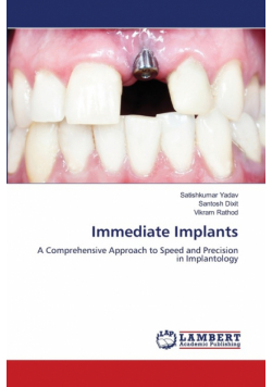 Immediate Implants