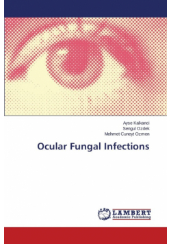Ocular Fungal Infections