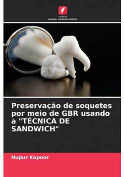 Preservação de soquetes por meio de GBR usando a "TÉCNICA DE SANDWICH"