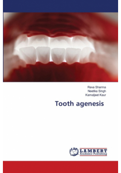 Tooth agenesis