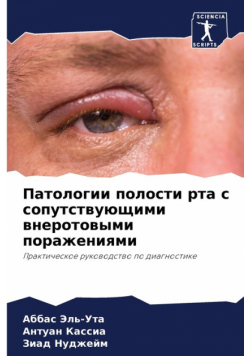 Патологии полости рта с сопутствующими внеротовыми поражениями