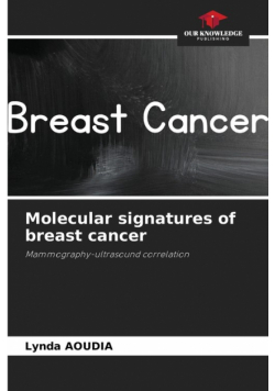 Molecular signatures of breast cancer