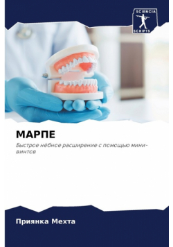 МАРПЕ
