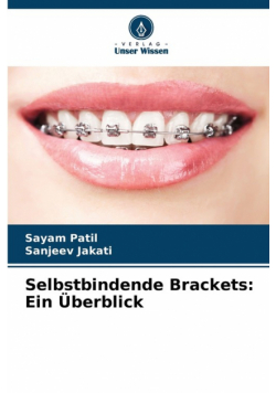 Selbstbindende Brackets