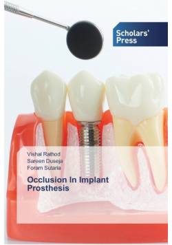 Occlusion In Implant Prosthesis