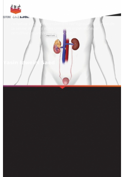 Traitement du reflux V-U par électrocoagulation