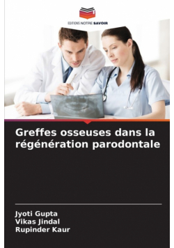 Greffes osseuses dans la régénération parodontale