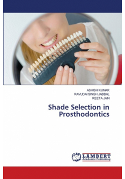 Shade Selection in Prosthodontics