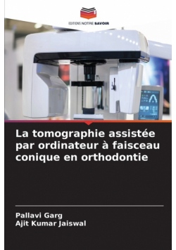 La tomographie assistée par ordinateur à faisceau conique en orthodontie