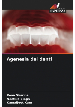 Agenesia dei denti