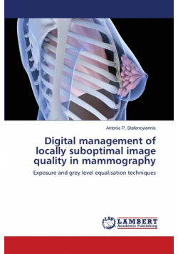 Digital management of locally suboptimal image quality in mammography