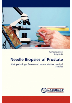 Needle Biopsies of Prostate