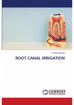 Root Canal Irrigation