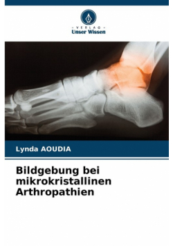 Bildgebung bei mikrokristallinen Arthropathien
