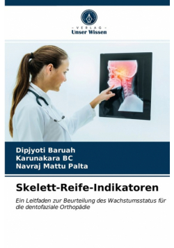 Skelett-Reife-Indikatoren