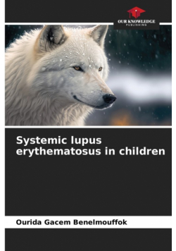 Systemic lupus erythematosus in children