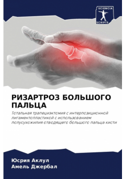 РИЗАРТРОЗ БОЛЬШОГО ПАЛЬЦА