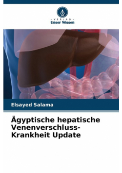 Ägyptische hepatische Venenverschluss-Krankheit Update