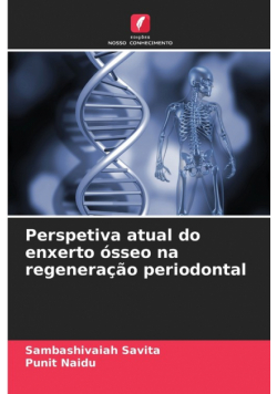 Perspetiva atual do enxerto ósseo na regeneração periodontal