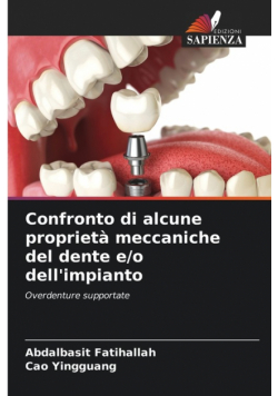 Confronto di alcune proprietà meccaniche del dente e/o dell'impianto