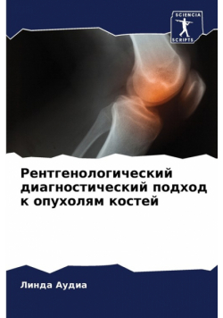 Рентгенологический диагностический подход к опухолям костей
