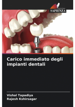 Carico immediato degli impianti dentali