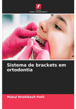 Sistema de brackets em ortodontia