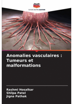 Anomalies vasculaires