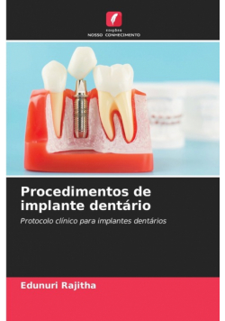 Procedimentos de implante dentário