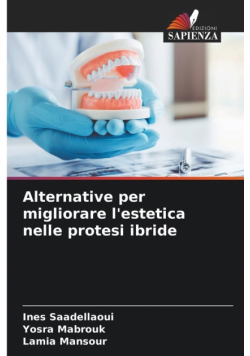 Alternative per migliorare l'estetica nelle protesi ibride