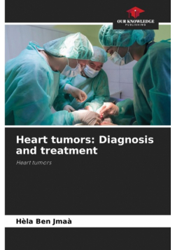 Heart tumors