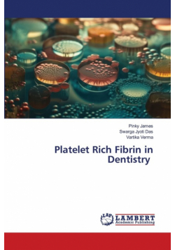 Platelet Rich Fibrin in Dentistry