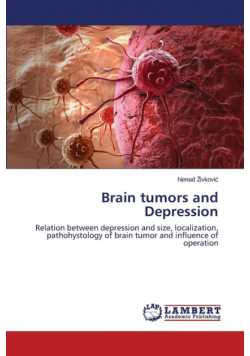 Brain Tumors and Depression