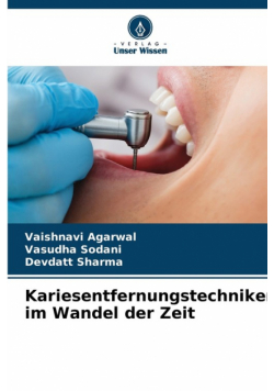 Kariesentfernungstechniken im Wandel der Zeit