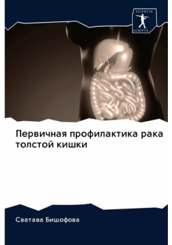 Первичная профилактика рака толстой кишки