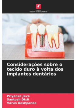 Considerações sobre o tecido duro à volta dos implantes dentários
