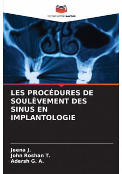 Les Procédures De Soulèvement Des Sinus En Implantologie