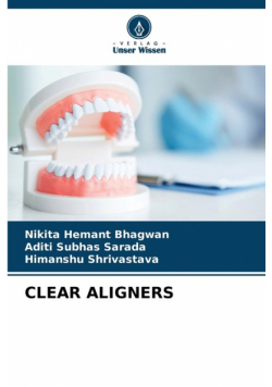 Clear Aligners