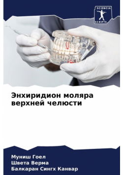 Энхиридион моляра верхней челюсти