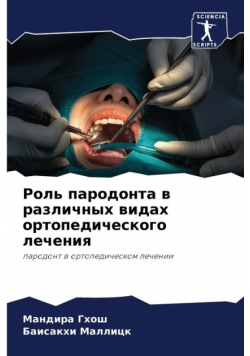 Роль пародонта в различных видах ортопедического лечения