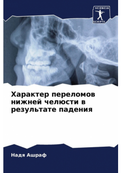 Характер переломов нижней челюсти в результате падения