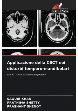 Applicazione della CBCT nei disturbi temporo-mandibolari