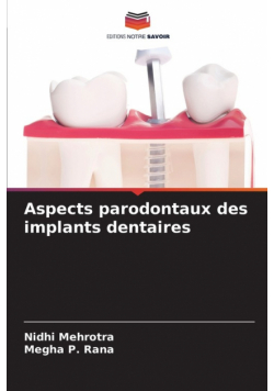 Aspects parodontaux des implants dentaires
